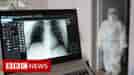 Some long Covid patients may have hidden damage to their lungs - BBC News